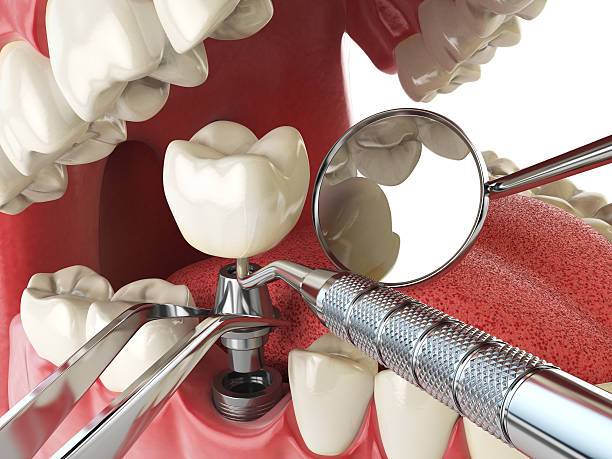 Best Emergency Gum Pain Relief  in Lemont, IL